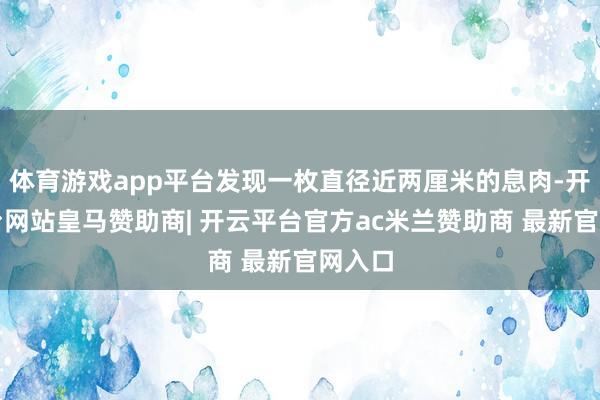体育游戏app平台发现一枚直径近两厘米的息肉-开云平台网站皇马赞助商| 开云平台官方ac米兰赞助商 最新官网入口